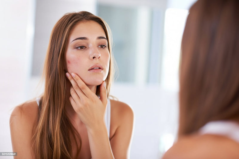 Pourquoi les routines skincare virales abiment plus qu'elles ne soignent
